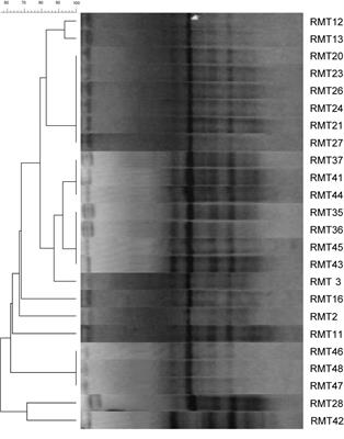 Nodulation of Retama monosperma by Ensifer aridi in an Abandonned Lead Mine Soils in Eastern Morocco